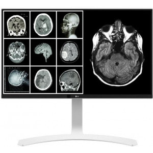 Monitor LED LG Clinical Review 27HJ712C-W 27 inch UHD IPS 14 ms 60 Hz DICOM